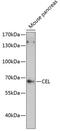 Carboxyl Ester Lipase antibody, 14-743, ProSci, Western Blot image 