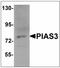 Protein Inhibitor Of Activated STAT 3 antibody, AP23956PU-N, Origene, Western Blot image 