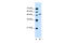 Nuclear receptor subfamily 1 group I member 2 antibody, 29-121, ProSci, Western Blot image 