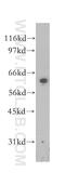 Squalene monooxygenase antibody, 12544-1-AP, Proteintech Group, Western Blot image 
