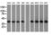 Sterol O-Acyltransferase 2 antibody, LS-C115246, Lifespan Biosciences, Western Blot image 