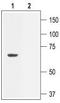 Potassium Calcium-Activated Channel Subfamily N Member 2 antibody, TA328940, Origene, Western Blot image 