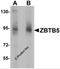 Zinc Finger And BTB Domain Containing 5 antibody, 6123, ProSci, Western Blot image 