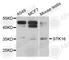 Serine/Threonine Kinase 16 antibody, A8166, ABclonal Technology, Western Blot image 