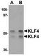 Kruppel Like Factor 4 antibody, TA306923, Origene, Western Blot image 