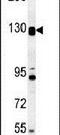 DENN Domain Containing 5B antibody, PA5-23797, Invitrogen Antibodies, Western Blot image 