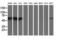 Cytosolic beta-glucosidase antibody, LS-C172841, Lifespan Biosciences, Western Blot image 
