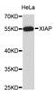 X-Linked Inhibitor Of Apoptosis antibody, STJ111196, St John