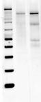 Nitric Oxide Synthase 1 antibody, GTX82905, GeneTex, Western Blot image 