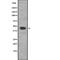 Phosphatidylinositol-5-Phosphate 4-Kinase Type 2 Alpha antibody, abx217781, Abbexa, Western Blot image 