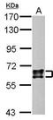 Dihydropyrimidinase-related protein 1 antibody, GTX110688, GeneTex, Western Blot image 