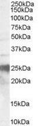 PRP antibody, GTX89339, GeneTex, Western Blot image 