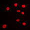 Histone Deacetylase 9 antibody, LS-C353208, Lifespan Biosciences, Immunofluorescence image 