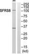 Splicing Factor SWAP antibody, TA314525, Origene, Western Blot image 
