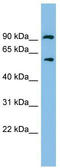 Aldehyde Dehydrogenase 7 Family Member A1 antibody, TA344576, Origene, Western Blot image 