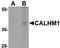 Calcium Homeostasis Modulator 1 antibody, TA306919, Origene, Western Blot image 