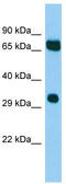 Maternal Embryonic Leucine Zipper Kinase antibody, TA339318, Origene, Western Blot image 