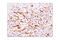 Vascular Cell Adhesion Molecule 1 antibody, 32653S, Cell Signaling Technology, Immunohistochemistry paraffin image 