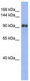 La Ribonucleoprotein Domain Family Member 1 antibody, TA343964, Origene, Western Blot image 