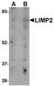 Limpii antibody, orb75012, Biorbyt, Western Blot image 