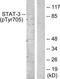 STAT3 antibody, TA326060, Origene, Western Blot image 
