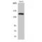 Phospholipase C Gamma 2 antibody, LS-C381201, Lifespan Biosciences, Western Blot image 