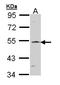 Recombining binding protein suppressor of hairless antibody, LS-C186261, Lifespan Biosciences, Western Blot image 