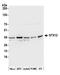 Syntaxin-12 antibody, A305-449A, Bethyl Labs, Western Blot image 