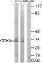 Cyclin Dependent Kinase 5 antibody, TA312176, Origene, Western Blot image 