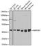 Mitogen-Activated Protein Kinase Kinase 4 antibody, GTX35224, GeneTex, Western Blot image 