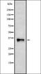 Purinergic Receptor P2Y12 antibody, orb336448, Biorbyt, Western Blot image 