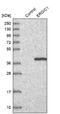 Endoplasmic Reticulum-Golgi Intermediate Compartment 1 antibody, NBP1-83962, Novus Biologicals, Western Blot image 