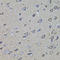 CD168 antibody, STJ114319, St John
