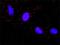 A-Raf Proto-Oncogene, Serine/Threonine Kinase antibody, H00000369-M05, Novus Biologicals, Proximity Ligation Assay image 