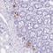 NADH:Ubiquinone Oxidoreductase Complex Assembly Factor 8 antibody, HPA057732, Atlas Antibodies, Immunohistochemistry frozen image 