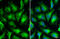 Human Papilloma virus antibody, GTX133412, GeneTex, Immunofluorescence image 