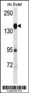 PLXNC1 antibody, 57-132, ProSci, Western Blot image 