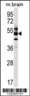 G Protein Pathway Suppressor 1 antibody, 56-595, ProSci, Western Blot image 