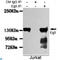 Kinesin-like protein KIF11 antibody, LS-C812951, Lifespan Biosciences, Immunoprecipitation image 