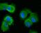 Tumor Protein P53 Inducible Nuclear Protein 1 antibody, NBP2-76860, Novus Biologicals, Immunofluorescence image 