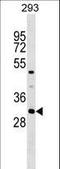 Ankyrin Repeat And SOCS Box Containing 7 antibody, LS-C159132, Lifespan Biosciences, Western Blot image 