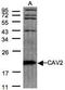 Caveolin-2 antibody, NBP1-31116, Novus Biologicals, Western Blot image 