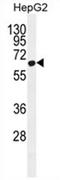 Zinc Finger CCCH-Type Containing 12A antibody, AP54619PU-N, Origene, Western Blot image 