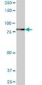 Ankyrin repeat and zinc finger domain-containing protein 1 antibody, H00055139-B01P, Novus Biologicals, Western Blot image 