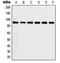 Heat shock protein HSP 90-alpha antibody, LS-C352335, Lifespan Biosciences, Western Blot image 