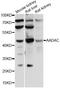 Arylacetamide Deacetylase antibody, LS-C748950, Lifespan Biosciences, Western Blot image 