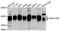 Endogenous Retrovirus Group FRD Member 1, Envelope antibody, A10162, ABclonal Technology, Western Blot image 