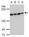 Structural maintenance of chromosomes protein 4 antibody, GTX129509, GeneTex, Western Blot image 