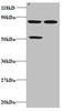 Abcd1 antibody, A51445-100, Epigentek, Western Blot image 