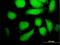 Mitogen-Activated Protein Kinase Kinase 5 antibody, H00005607-M11, Novus Biologicals, Immunocytochemistry image 
